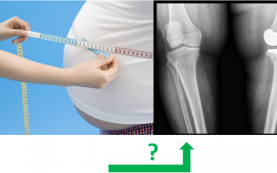 Interrelation entre arthrose et syndrome métabolique : Un lien commun ?